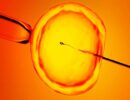 63821831